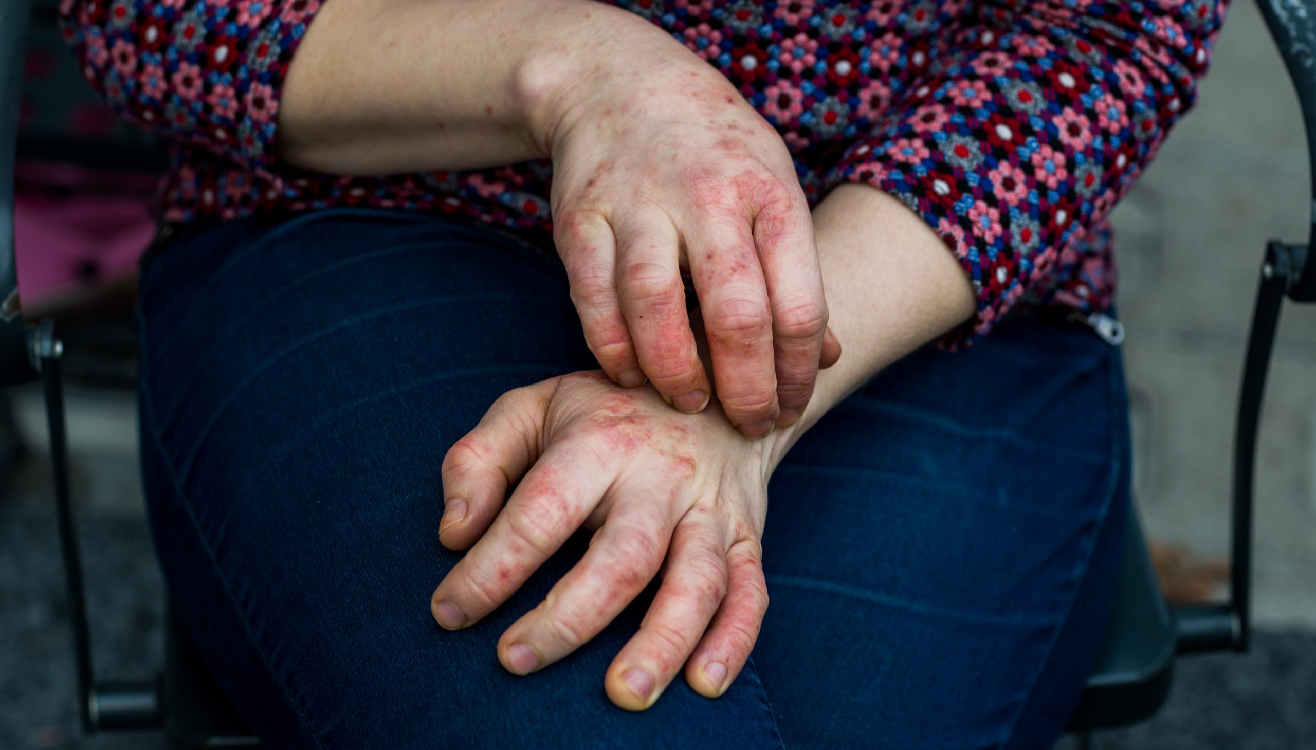 Ekzem DocFinder Wissensmagazin